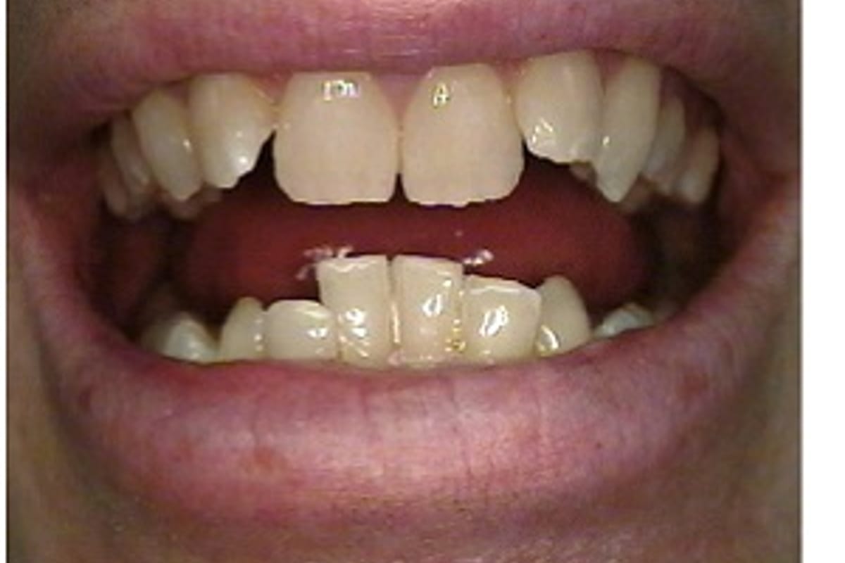 Child and teen dental alignment assessment reference