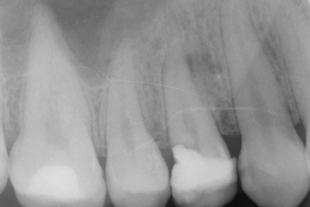 Damaged tooth assessment reference for professional dental care