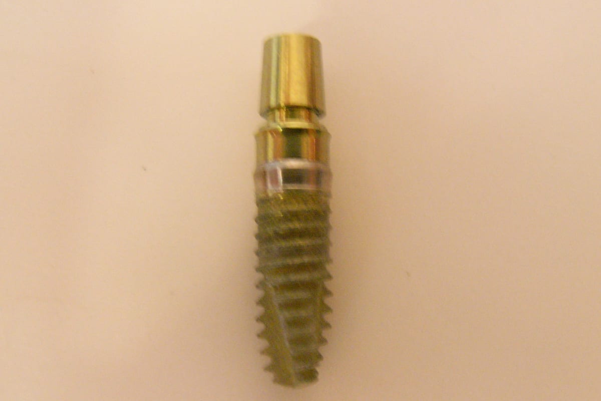 Dental implant fixture reference image