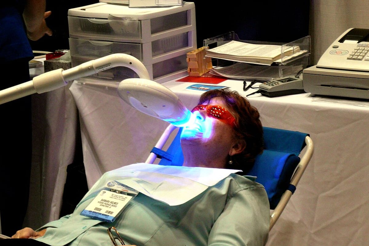 Real in-office teeth whitening process reference photo